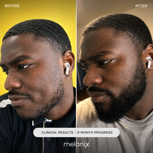 Melanix Beard Growth Serum