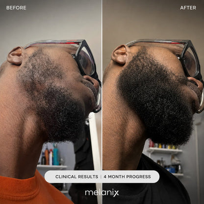 Melanix Beard Growth Serum
