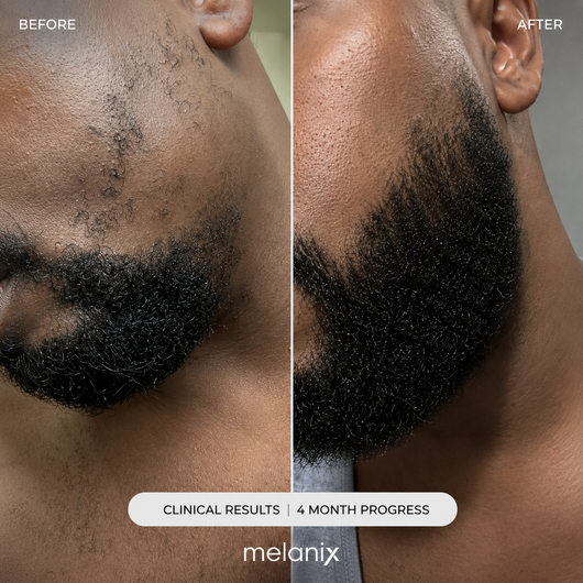 Melanix Beard Growth Serum